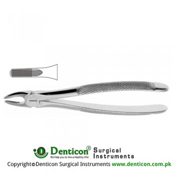 English Pattern Tooth Extracting Forcep Fig. 2 (For Upper Laterals) Stainless Steel, Standard